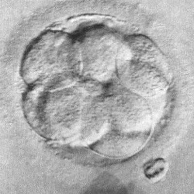 Embryo