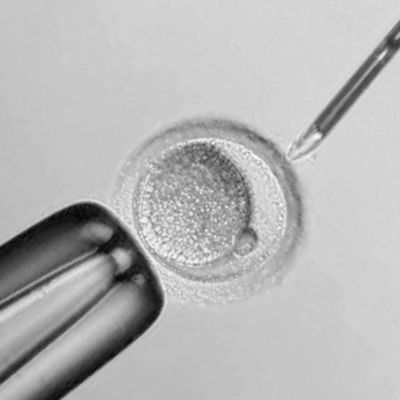 In Vitro Fertilisation